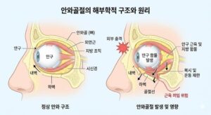 안와골절 증상과 치료, 시력 보호를 위한 골든타임 복원